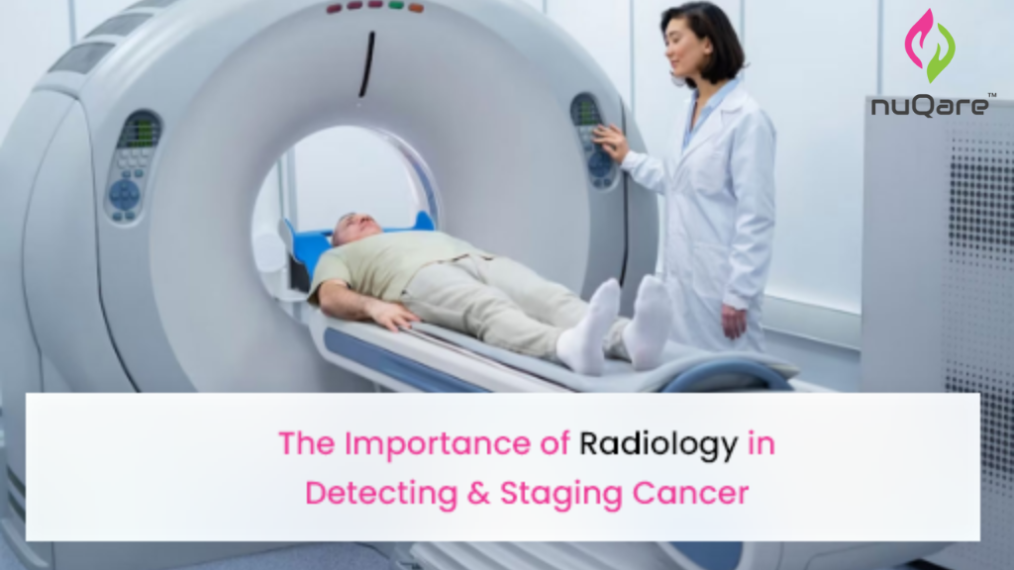 The Importance Of Radiology In Detecting And Staging Cancer – Nuqare