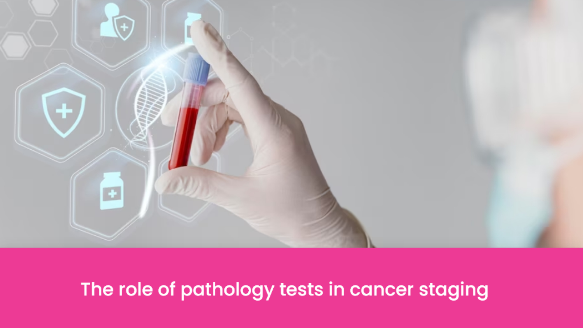 The role of pathology tests in cancer staging